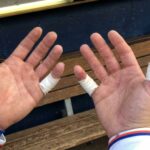 Mets Catcher Plays Through 4 Hand Injuries In 24 Months—Then His Bat Explodes Mid-Swing