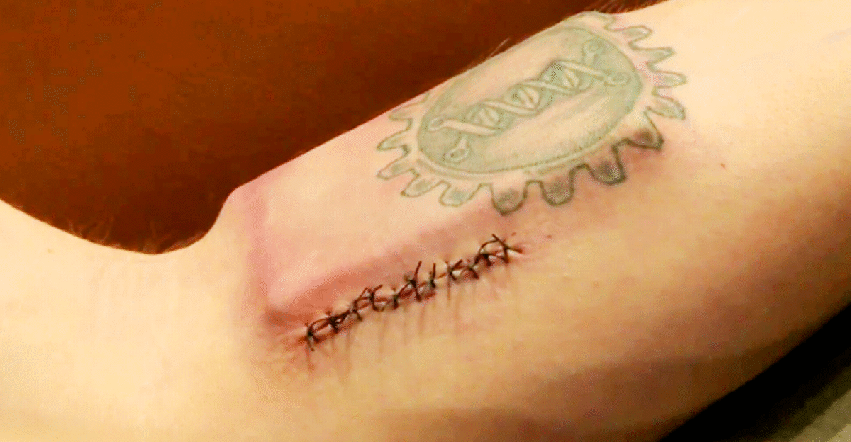 Man implants cyborg chip into arm to link up with his Android tablet by Trend Dictionary