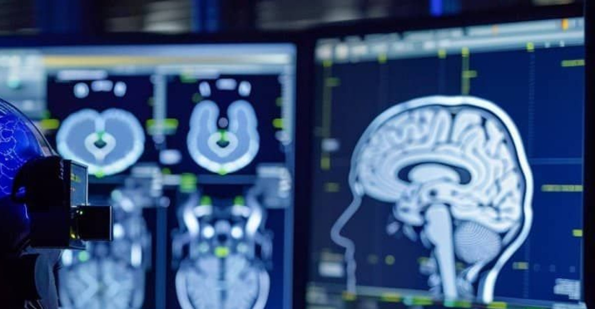 Brain activity mapping with brain-computer interface technology by Tom Scalabre
