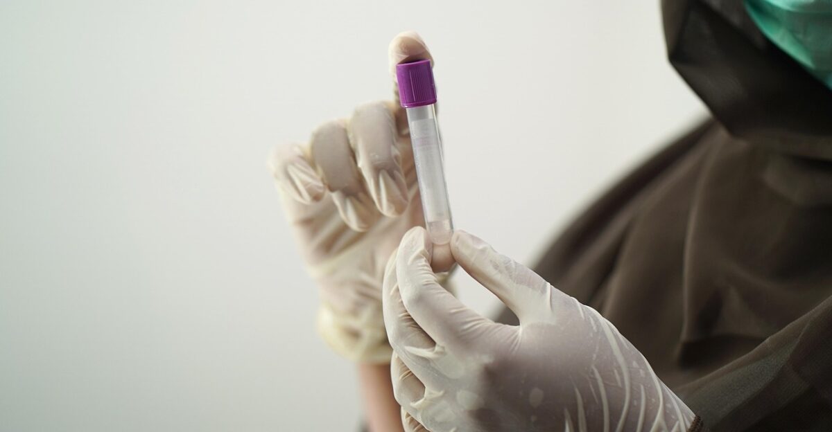 blood test blood sample medical technology medical technologist surgical gloves face mask sample hospital worker laboratory lab blood test blood test blood test blood test blood test sample laboratory laboratory laboratory lab lab