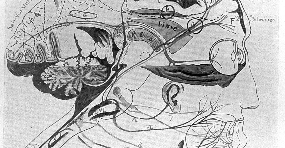 Detail of brain in aphasia General Collections Keywords Salomon Eberhard Henschen