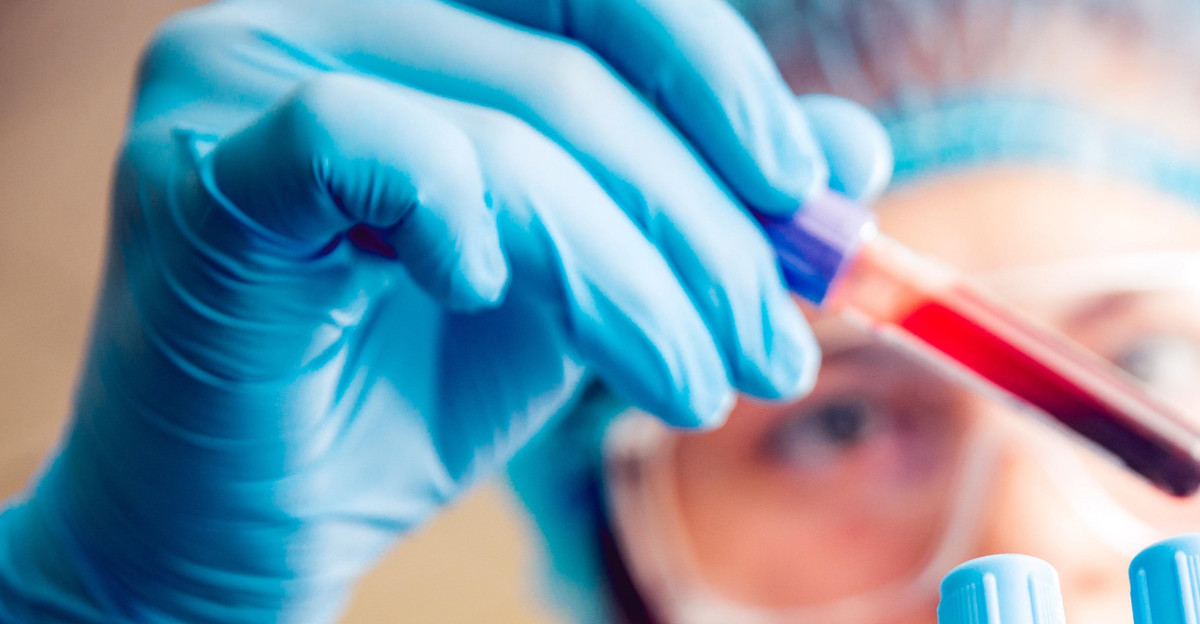 Laboratory Tests MedlinePlus