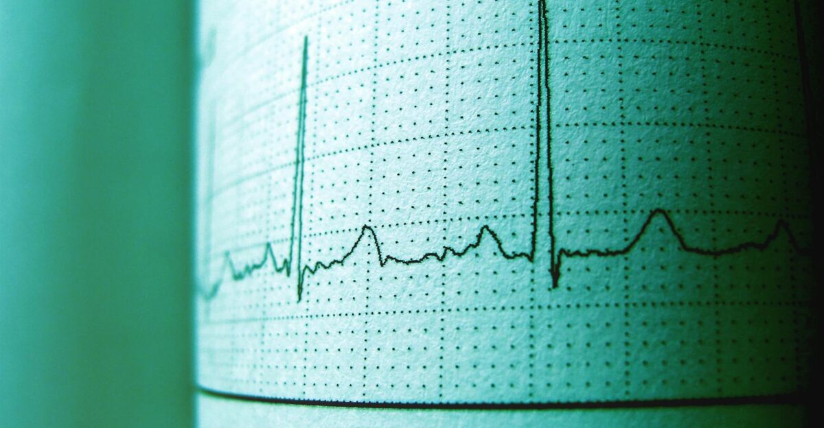 Close-up of an ECG printout displaying heartbeat rhythm and frequency for medical analysis