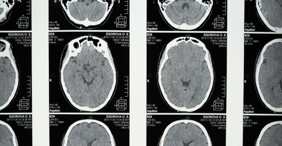 Comprehensive set of brain MRI scans highlighting cranial anatomy for medical use