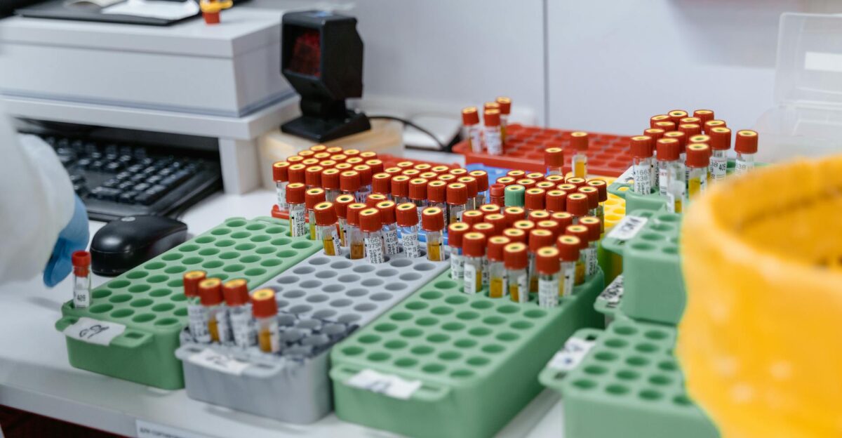 Blood samples in a lab ready for testing and research Organized for efficient processing