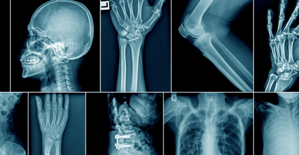 X-ray - skeleton