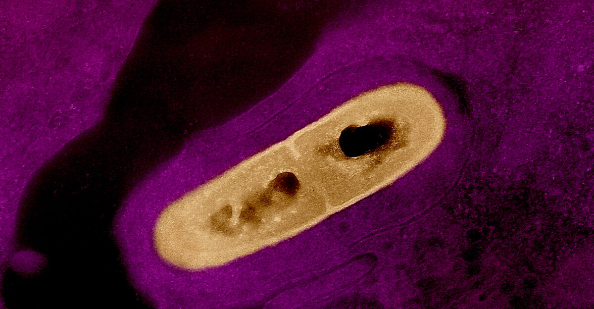 Colorized transmission electron micrograph of a Listeria bacterium yellow in tissue This pathogen causes the food borne illness listeriosis Microscopy by CDC colorization and visual effects by NIAID Credit CDC and NIAID Note original CDC micrograph can be found on CDC PHIL under Image ID 2286 Content Providers CDC Dr Balasubr Swaminathan Peggy Hayes CDC Photo Credit 2287 Colorization visual effects done independently by NIAID Both CDC and NIAID are part of the U S Department of Health and Human Services HHS works are in the public domain and may be reused freely