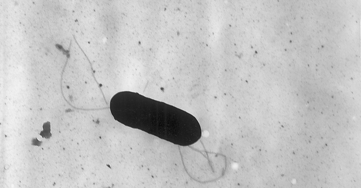 Electron micrograph of a flagellated Listeria monocytogenes bacterium Magnified 41 250X Listeria monocytogenes is the infectious agent responsible for the food borne illness Listeriosis In the United States an estimated 2 500 persons become seriously ill with listeriosis each year Of these 500 die Typical size of Listeria rods 0 4 by 1 to 1 5 m