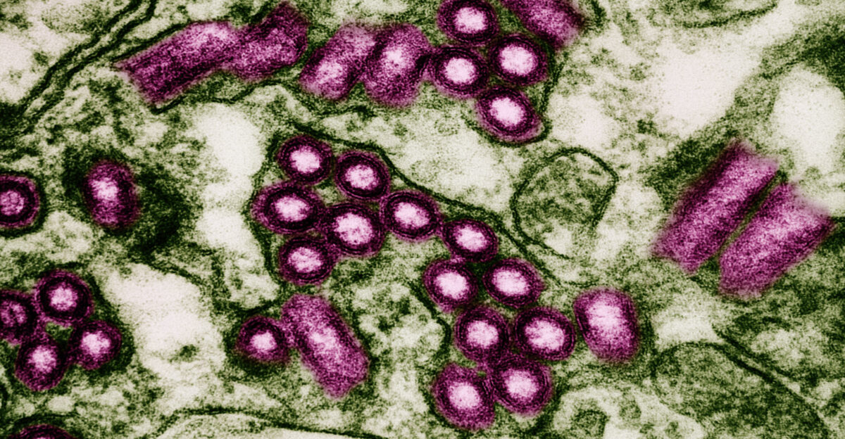 Colorized transmission electron micrograph of rabies virus particles pink replicating in the cytoplasm of an infected VERO E6 cell green Image captured at the NIAID Integrated Research Facility in Fort Detrick Maryland Credit NIAID Per CDC rabies still claims nearly 70 000 lives annually despite the existence of a vaccine and other prevention measures Rabies is one of the most neglected tropical diseases in underserved regions of the world disproportionally affecting rural poor populations and children with limited access to healthcare and veterinary services