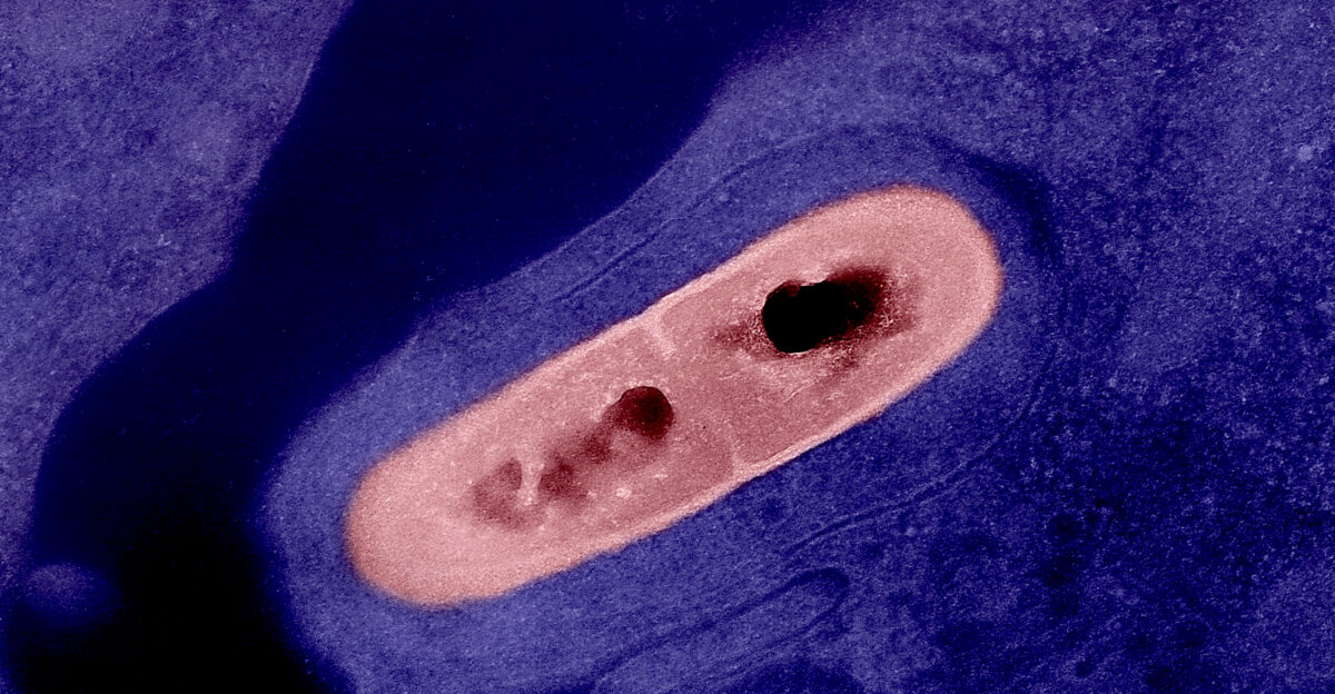 Colorized transmission electron micrograph of a Listeria bacterium pink in tissue This pathogen causes the food borne illness listeriosis Microscopy by CDC colorization and visual effects by NIAID Credit CDC and NIAID Note original CDC micrograph can be found on CDC PHIL under Image ID 2286 Content Providers CDC Dr Balasubr Swaminathan Peggy Hayes CDC Photo Credit 2287 Colorization visual effects done independently by NIAID Both CDC and NIAID are part of the U S Department of Health and Human Services HHS works are in the public domain and may be reused freely