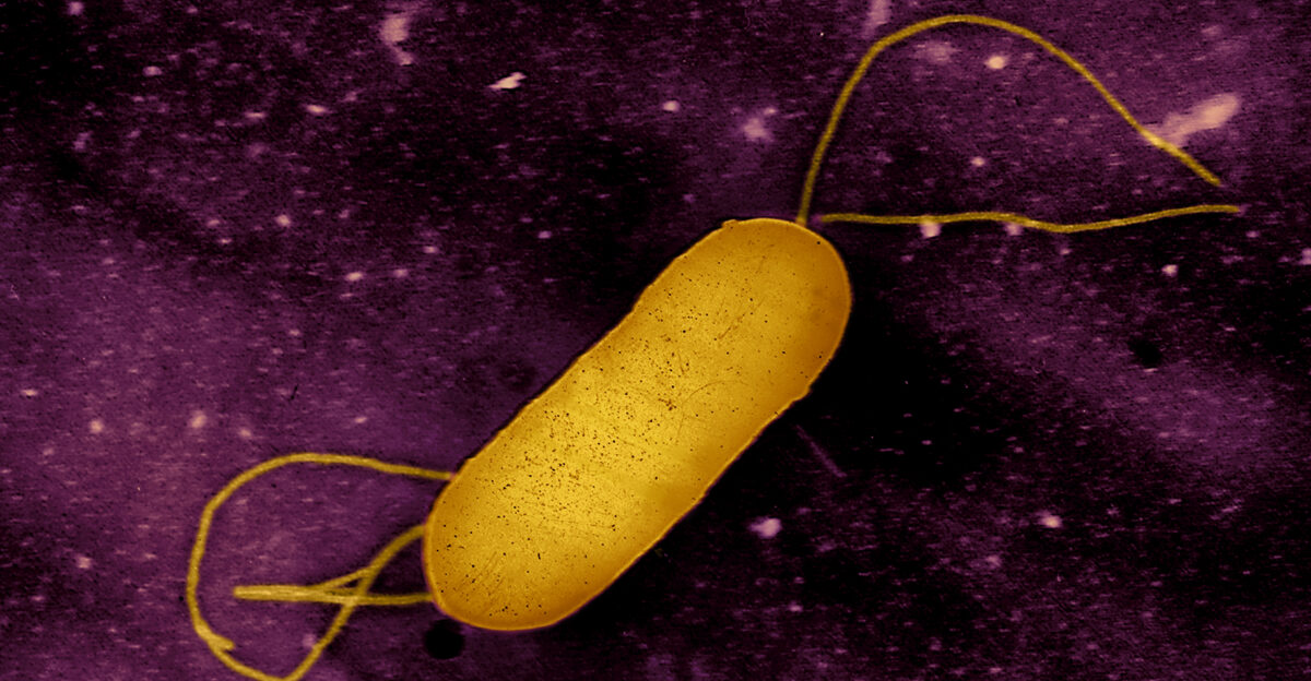 Colorized transmission electron micrograph of a flagellated Listeria bacterium This pathogen causes the food borne illness listeriosis Microscopy by CDC colorization and visual effects by NIAID Credit CDC and NIAID Note original CDC micrograph can be found on CDC PHIL under Image ID 2287