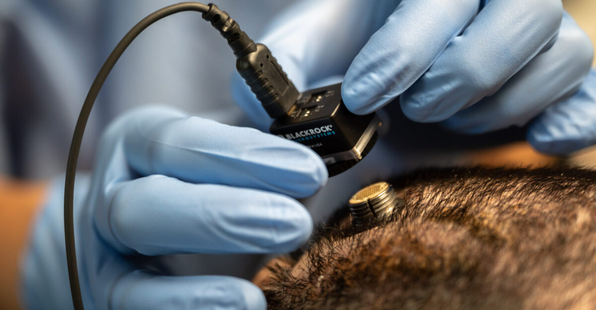 Brain-computer interface - Wikipedia