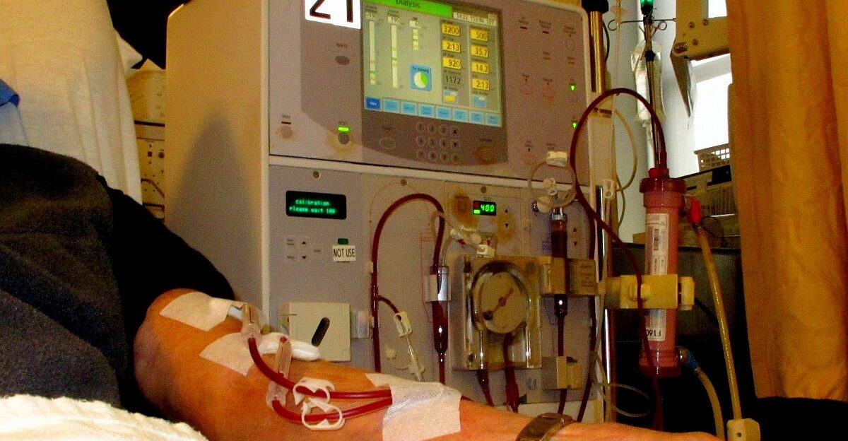 Arm of patient receiving dialysis