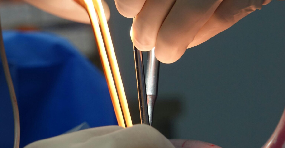 Close-up of a surgeon operating in a sterile environment using surgical instruments.