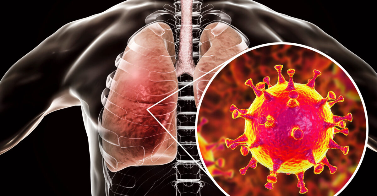 Middle East Respiratory Syndrome MERS - Naugatuck Valley Health