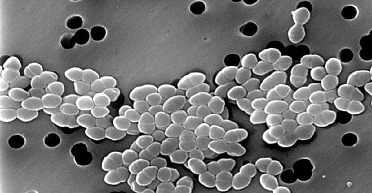 Scanning Electron Micrograph of Vancomycin Resistant Enterococci