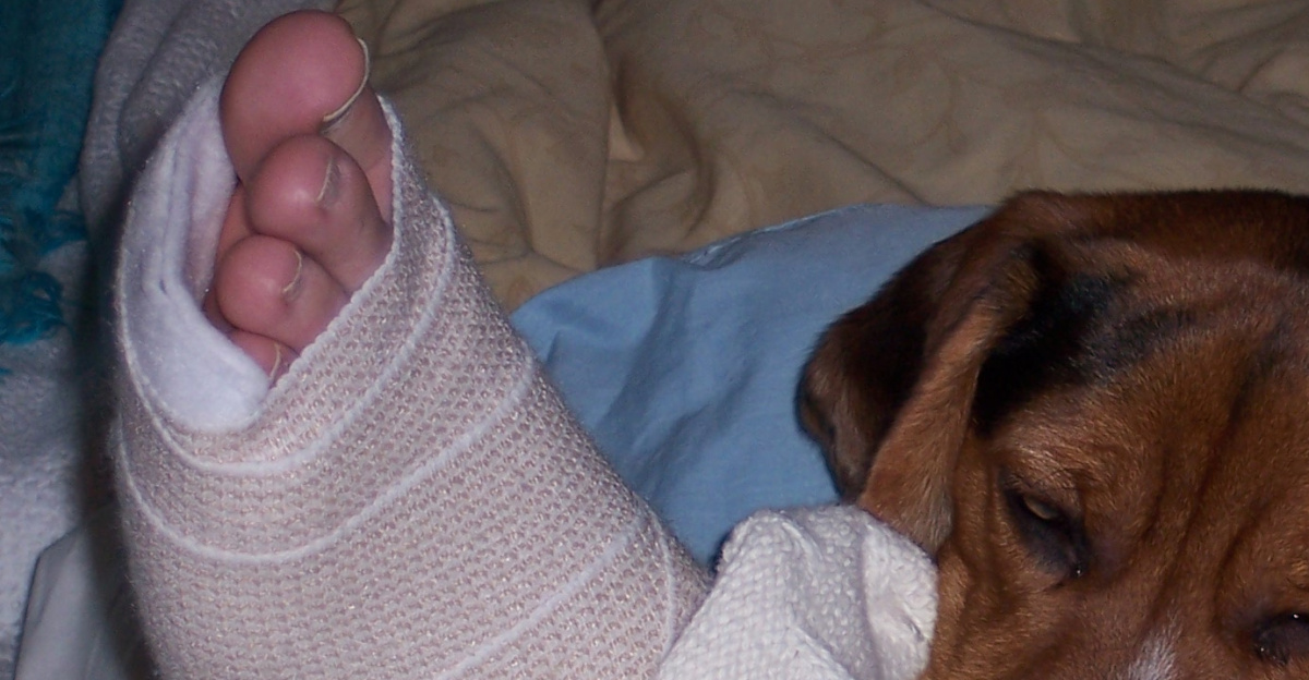 Beagle and Broken Ankle
