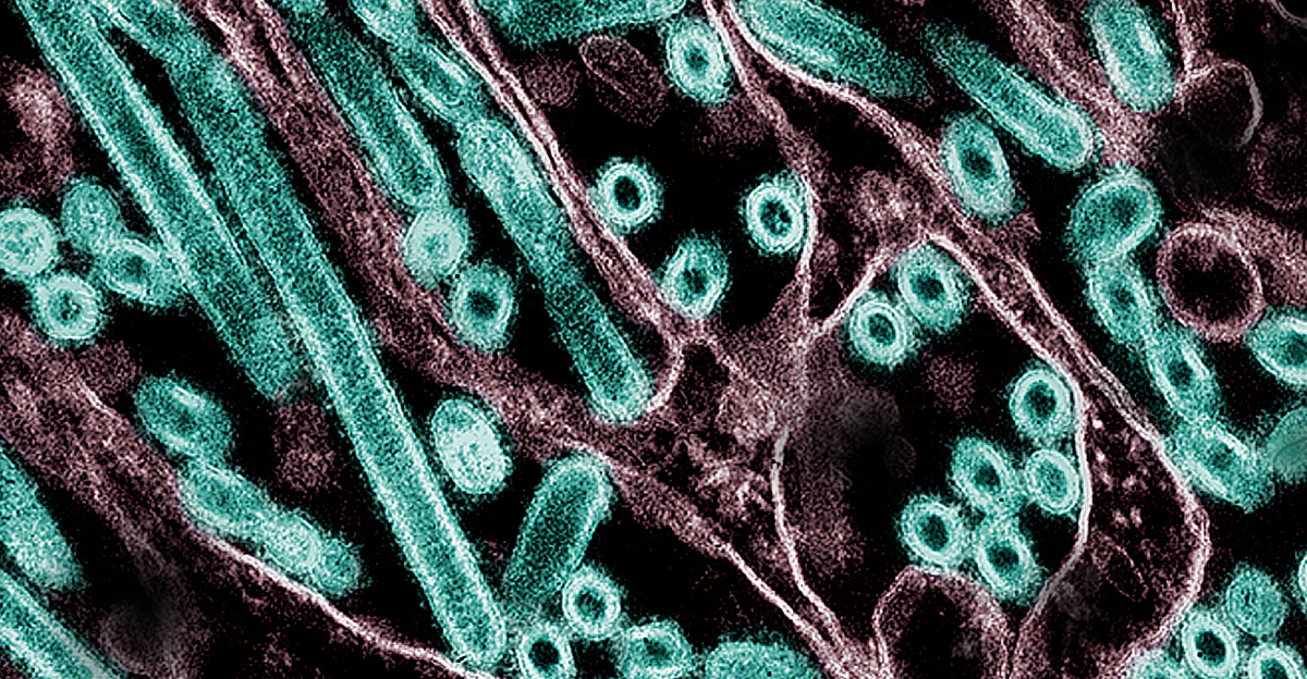 Colorized transmission electron micrograph of avian influenza A H5N1 virus particles (green), grown in Madin-Darby Canine Kidney (MDCK) epithelial cells. Microscopy by CDC; repositioned and recolored by NIAID. Credit: CDC and NIAID